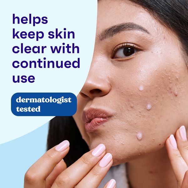 Clean & Clear Advantage Acne Spot Treatment Gel Cream with Salicylic Acid and Witch Hazel - .75 fl oz
