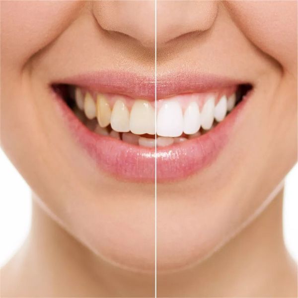 Rembrandt Deeply White + Peroxide Whitening Toothpaste with Fluoride, Removes Tough Stains, Rehardens and Strengthens Enamel - Peppermint - 3.5oz