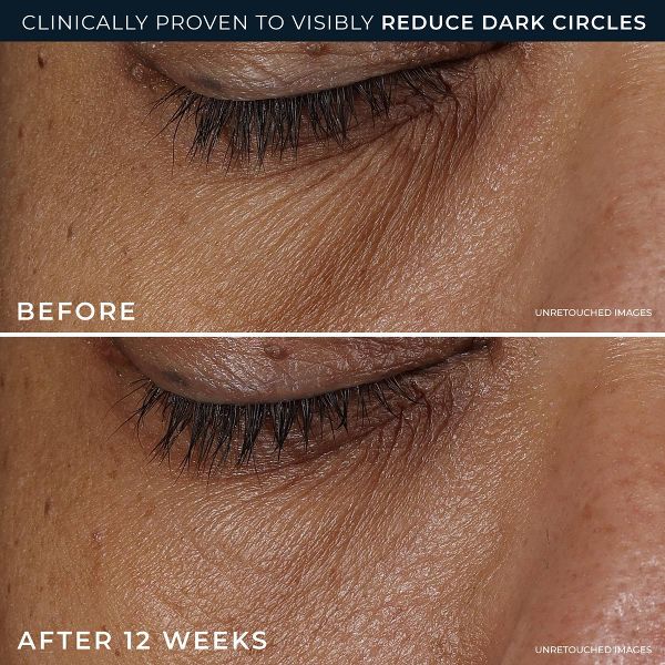 RoC Derm Correxion Dark Circle Eye Repair Cream - 15ml
