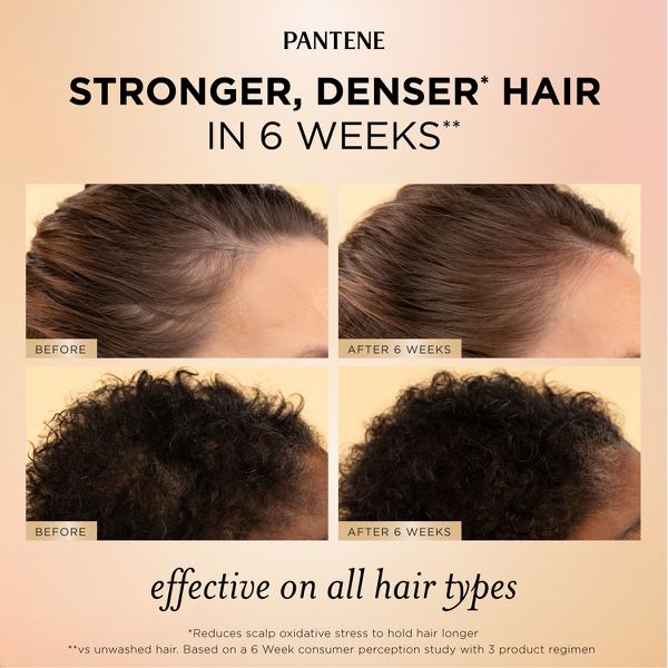 Pantene Abundant & Strong Treatment Serum - 2 fl oz