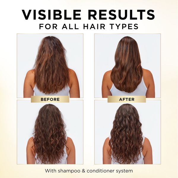 Pantene Pro-V Daily Moisture Renewal Conditioner - 10.4 fl oz