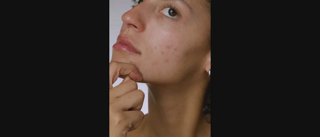 e.l.f. SKIN Blemish Breakthrough Stick It to Zits Pimple Patches - 36ct