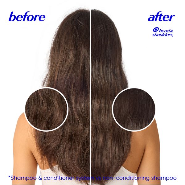 Head and Shoulders Anti-Dandruff Treatment, Dry Scalp Care for Daily Use, Paraben-Free Shampoo - 20.7 fl oz