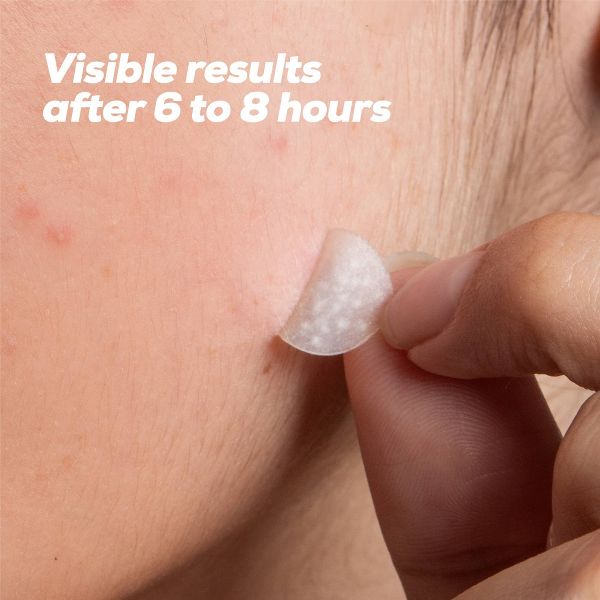 HANHOO Original Blemish Patch - 36ct