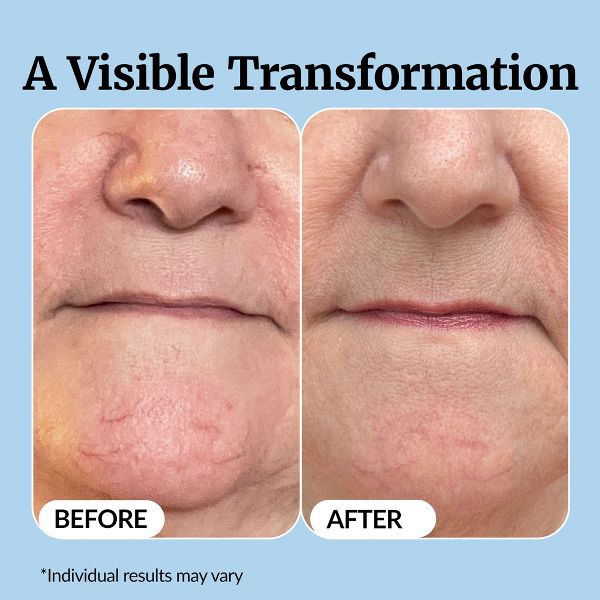 Vibriance Super C Serum for Mature Skin - All-in-One Vitamin Formula Hydrates, Firms, Lifts, Smooths, Targets Age Spots, Wrinkles, 1 fl oz