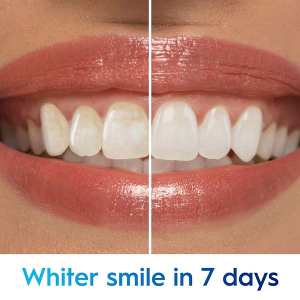 Crest 3D White Glamorous White Alcohol Free Multi-Care Whitening Mouthwash - 946 ml